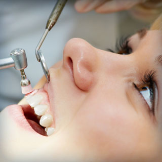 teeth-cleaning-girl